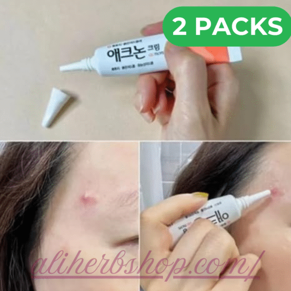 Noscarna Scar Gel – Extra Value Pack (13g, Pack of 2) | Advanced Scar Removal for Keloids, Acne & Surgery Scars - Image 4